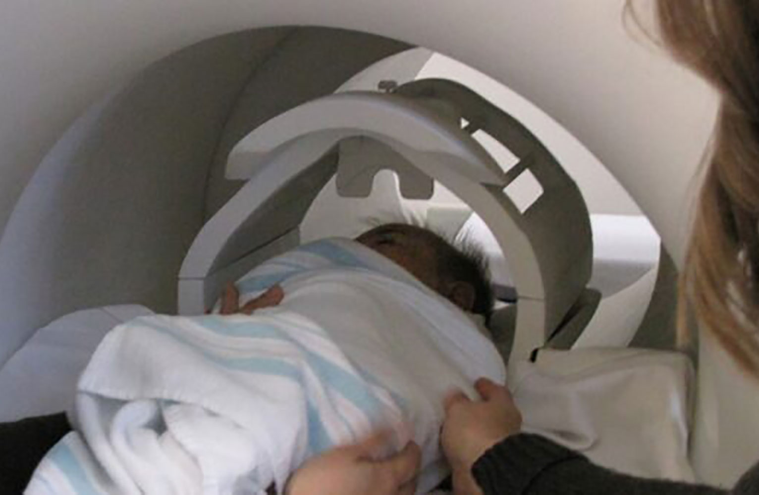 Sleeping baby prior to MRI. (CIDD at UNC-CH)